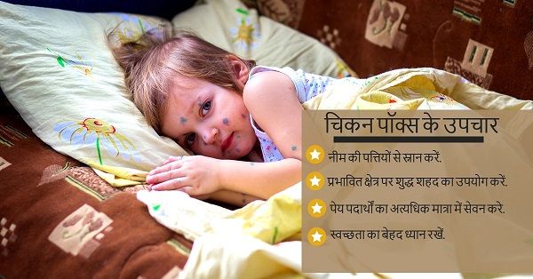 अप्रैल स्वास्थ्य विशेषांक – ऋतु परिवर्तन के सूचक माह में पाएं निरोगी तन-मन-